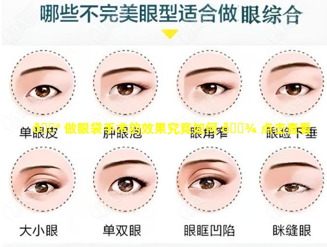 💮 做眼袋手术的效果究竟如何 🌾 点击查看